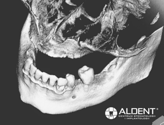 Kompleksowa Diagnostyka i Indywidualne Podejście