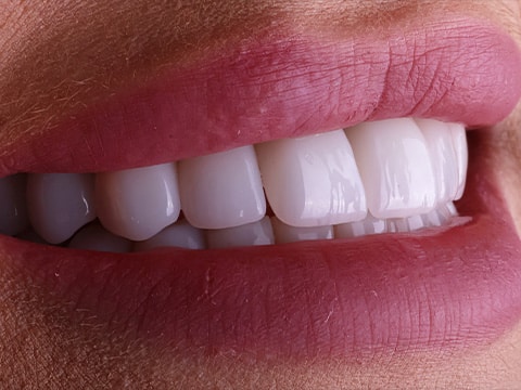 odbudowa protetyczna