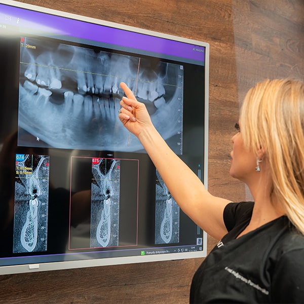 Podnoszenie zatok szczękowych