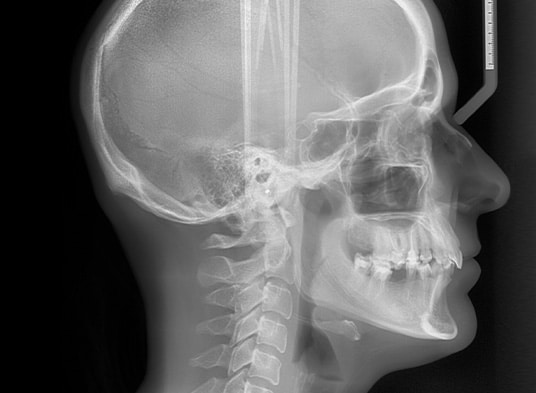 Zdjęcia cefalometryczne