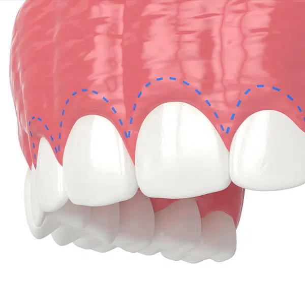 Chirurgia stomatologiczna, szczękowa - Aldent Lublin