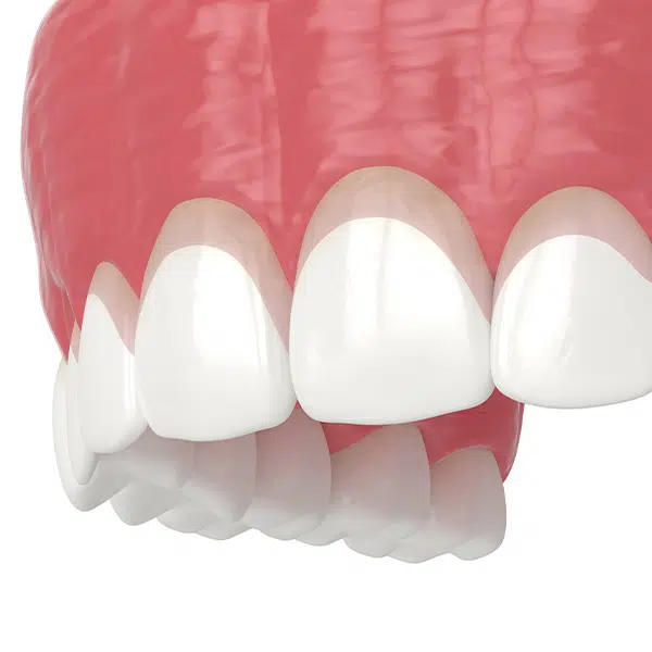 Chirurgia stomatologiczna, szczękowa - Aldent Lublin gumy mile