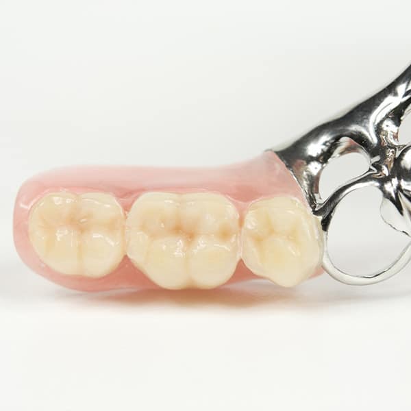 Komfortowe cześciowe protezy zębowe