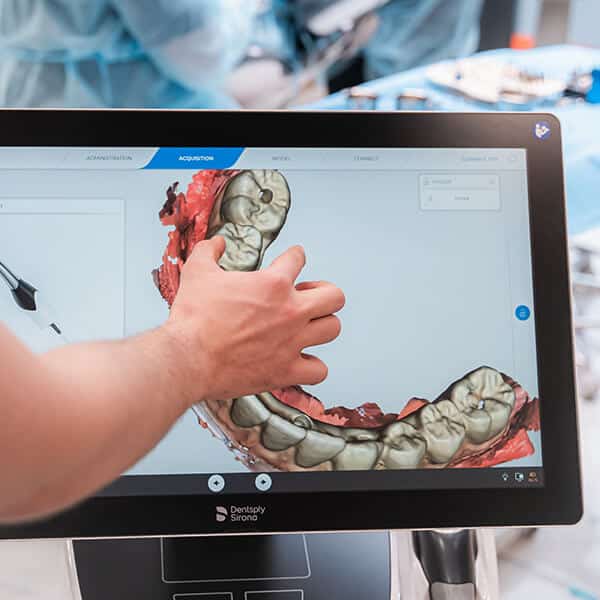 Nowoczesna odbudowa uzębienia