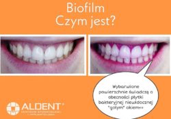 guided biofilm therapy