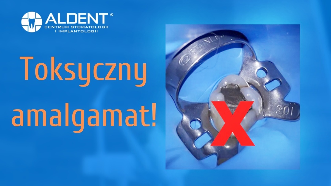 Wymiana amalgamatów Lublin