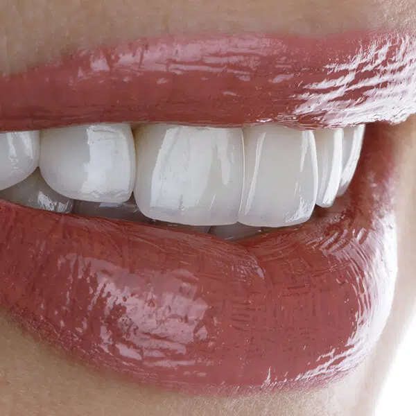 Proces gojenia po implantach