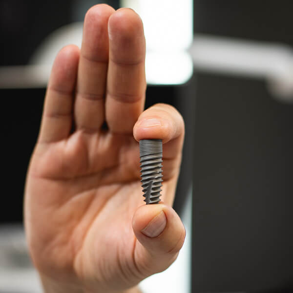 implant zębowy aldent lublin