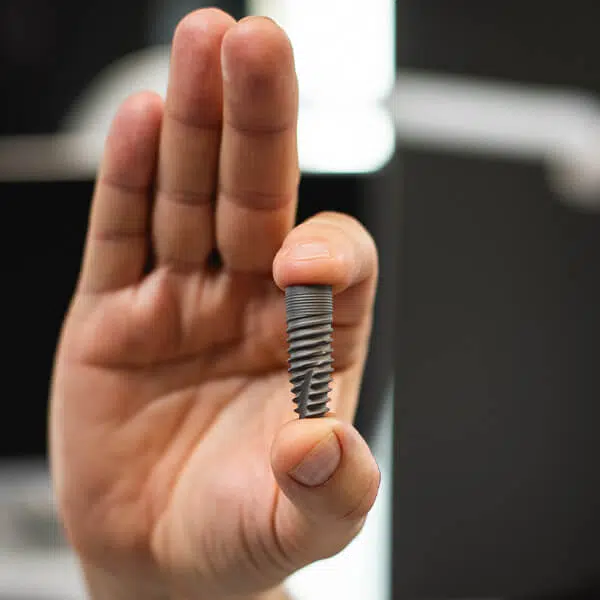 implant zębowy aldent lublin