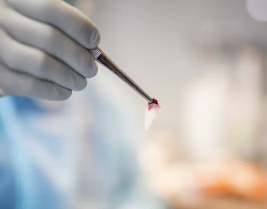 regeneracja tkanek W CHIRURGII STOMATOLOGICZNEJ LUBLIN ALDENT