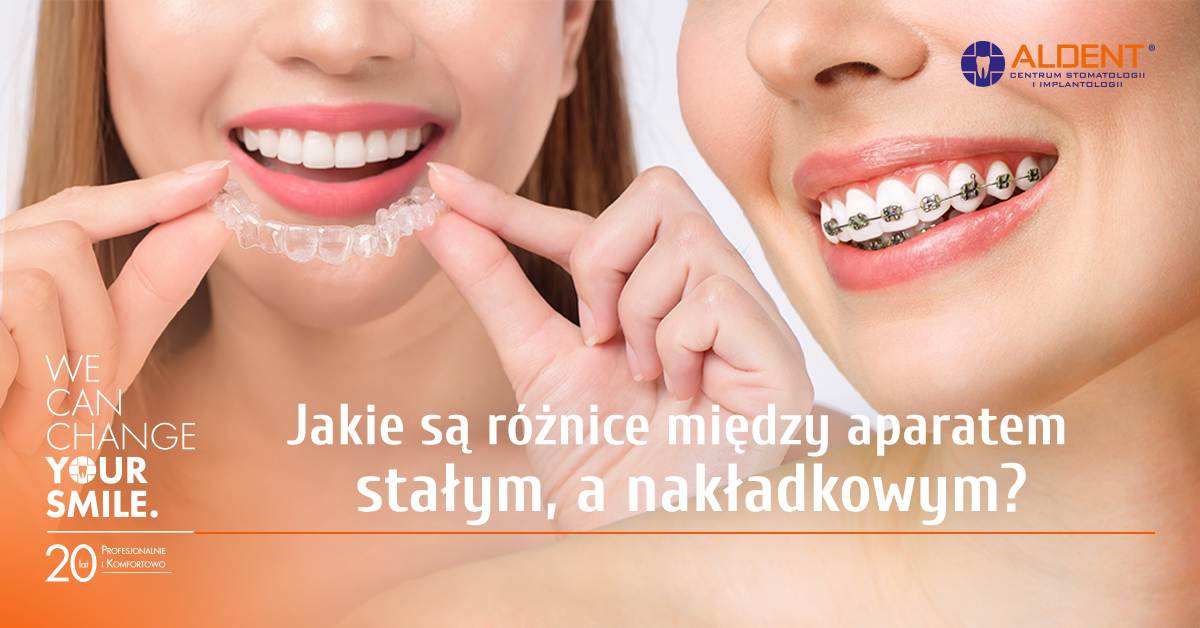 jakie są różnice między aparatem stałym a nakładkowym