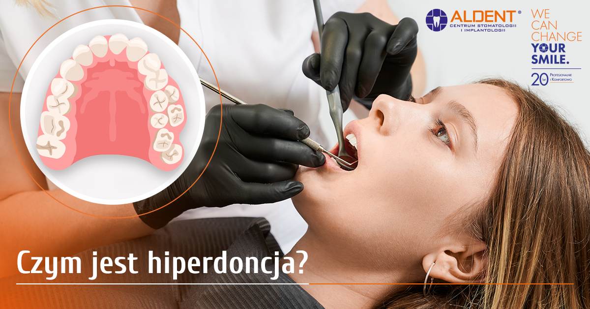 co to jest hiperdoncja