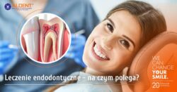 leczenie endodontyczne