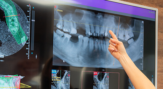 Implantacja natychmiastowa i odroczona