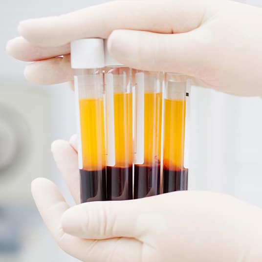 Innowacyjne metody leczenia paradontozy