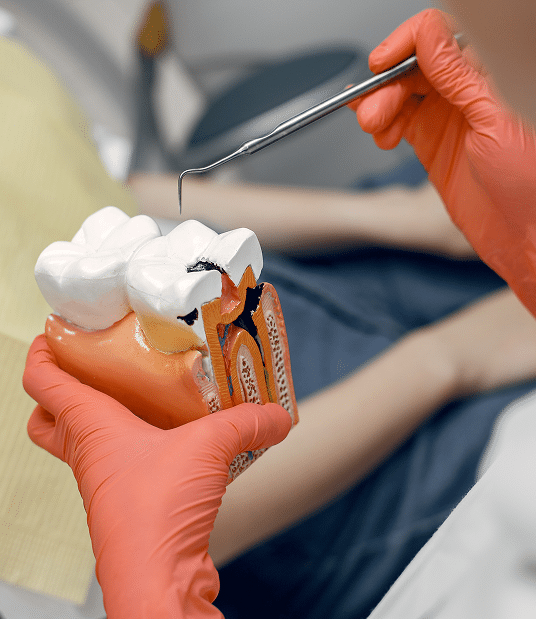 Leczenie próchnicy zębów