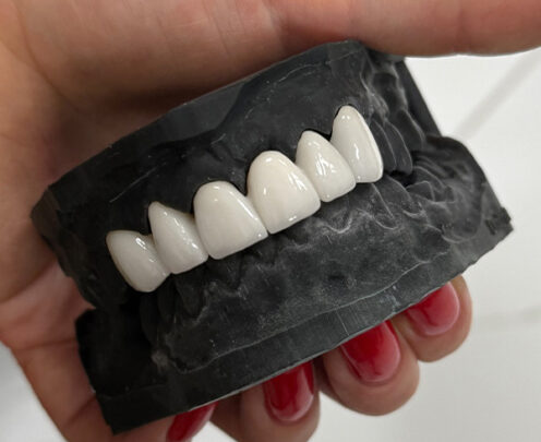 Protetyka cyfrowa Lublin aldent