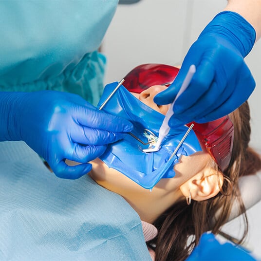 Wymiana wypełnień amalgamatowych