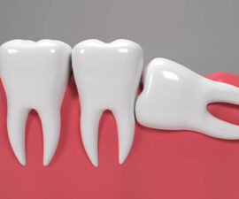 usuwanie ósemek w lublinie chirurgia stomatologiczna aldent