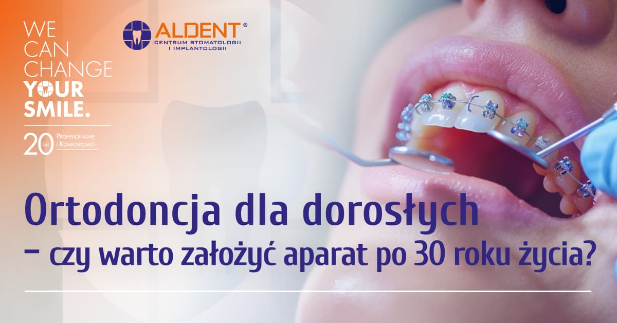 ortodoncja dla doroslych