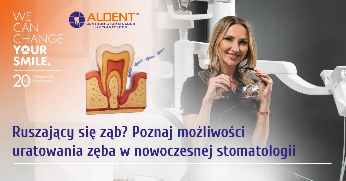 ruszający się ząb