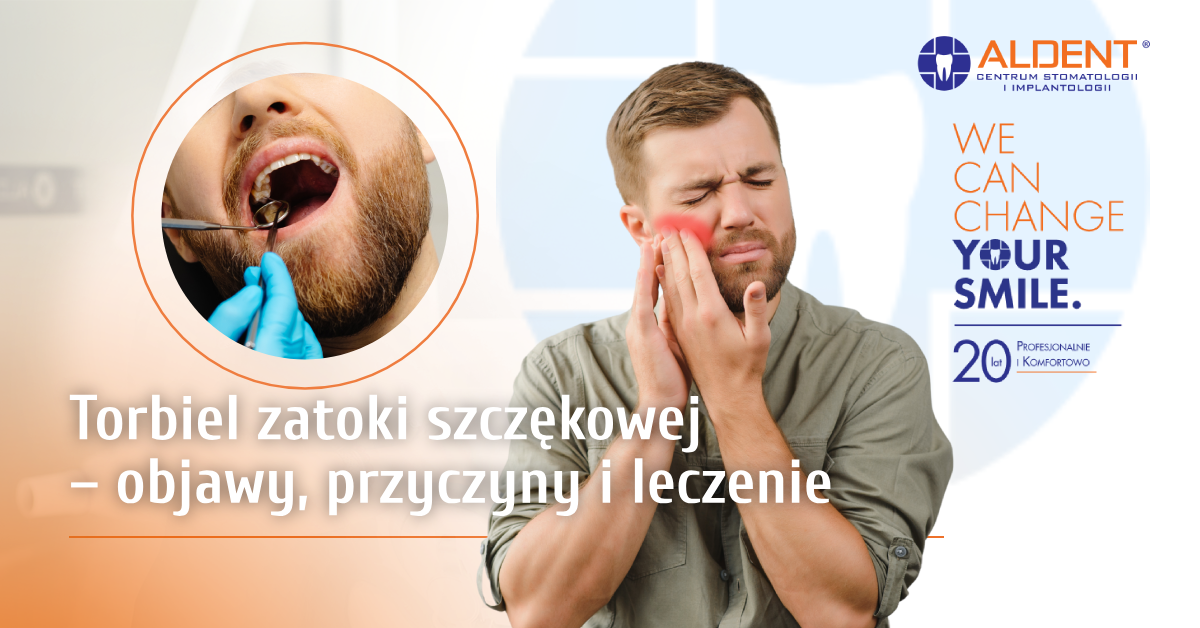 torbiel zatoki szczękowej